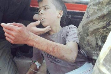 مسلحو حلب يذبحون طفلا في منطقة مخيم حندرات