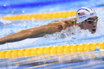 لماذا يلجأ أبطال الأولمبياد إلى الحجامة؟