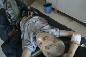 إصابة الطفل حيدر عمار الحمود في بلدة الفوعة