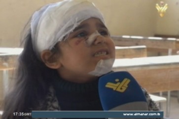 طفلة جريحة في حلب