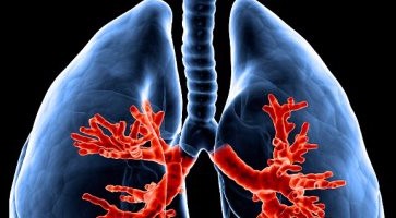 تناول جرعات منتظمة من "ايبوبروفين" قد يخفض خطر الإصابة بسرطان الرئة للمدخنين