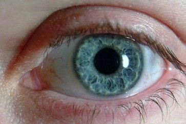خطوات بسيطة تساعد على الوقاية من الإصابة بالمياه الزرقاء على العين،