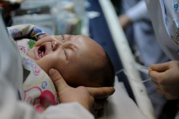الوخز يقلّص فترات بكاء الأطفال الرضع