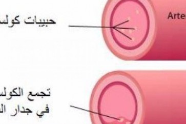 4 طرق لخفض كولسترول الدم ومنع الإصابة بالنوبات القلبية.. تعرف عليها