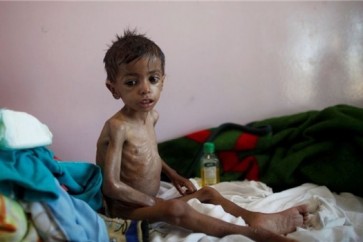 مجاعة اليمنيين